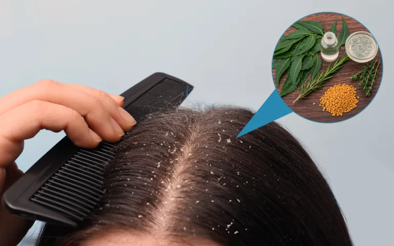 A woman uses a comb on her hair, with a plant nearby, representing herbal solutions for dandruff and scalp health.