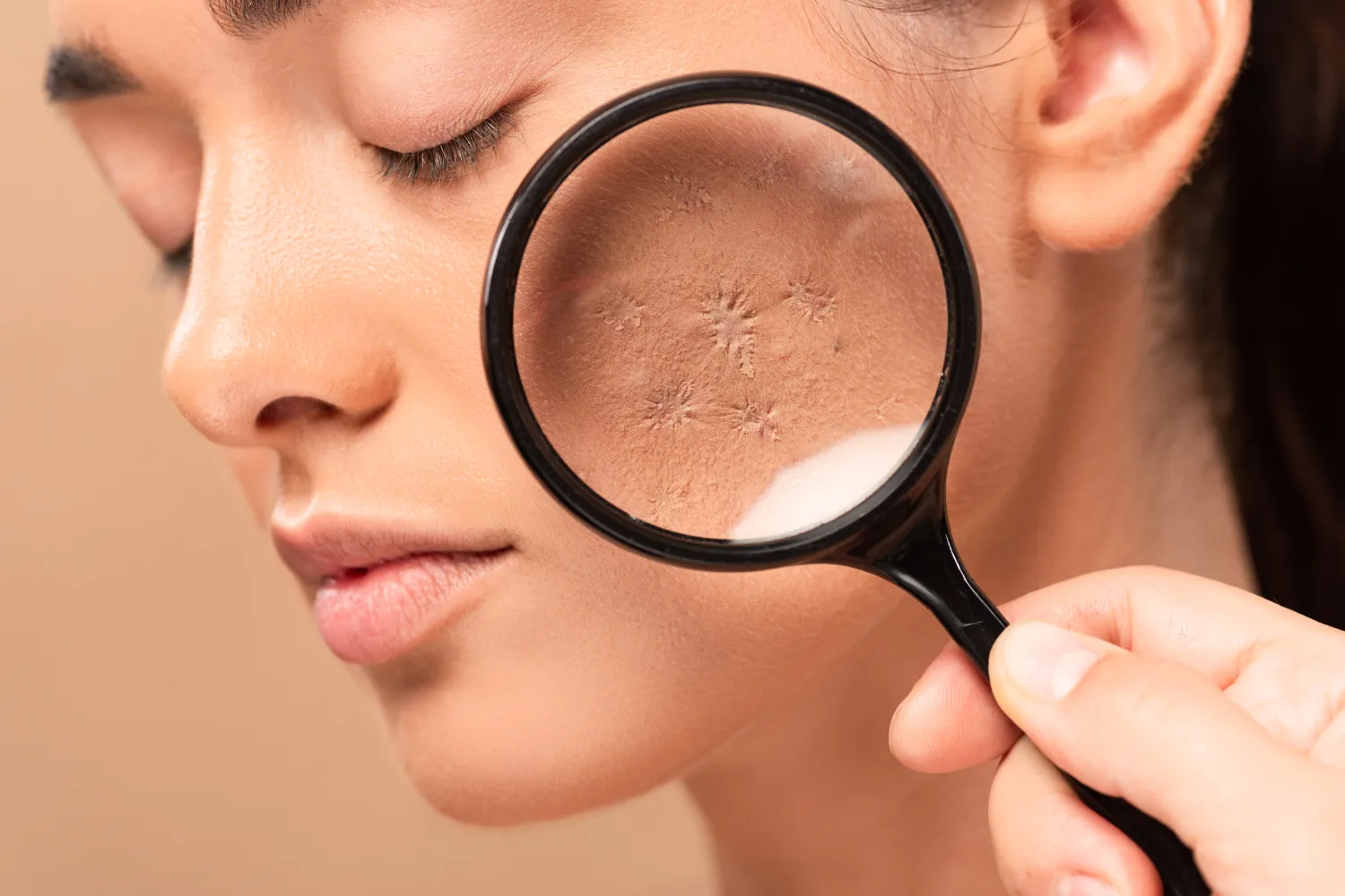 Close-up of facial skin viewed through a magnifying glass, showing dryness and texture changes often linked to imbalanced glucose levels.
