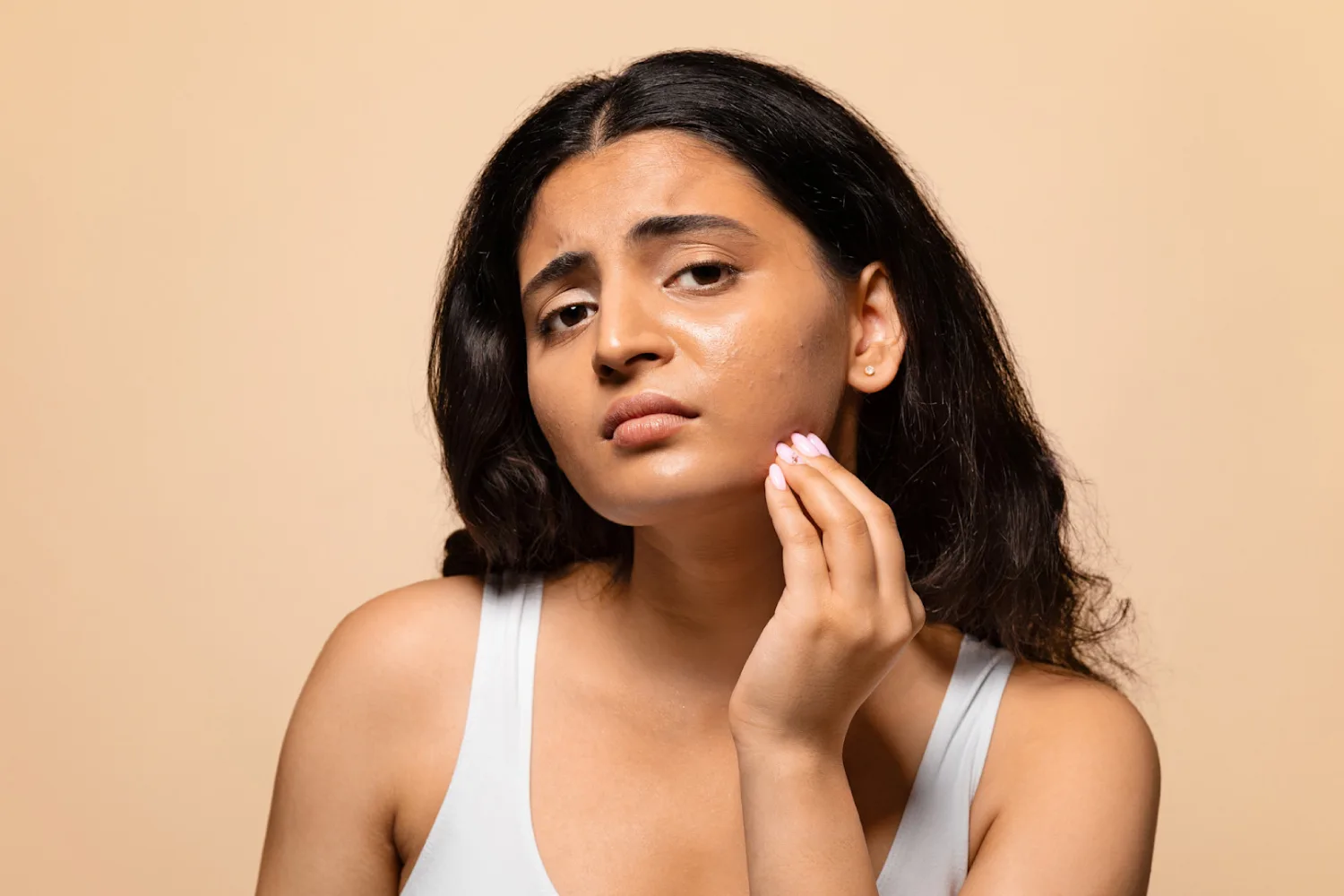 Woman touching her cheek with visible skin concerns, illustrating how fluctuating blood glucose levels may affect skin clarity and tone.